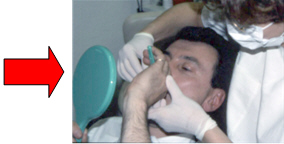 I batteri causano carie e malattie parodontali